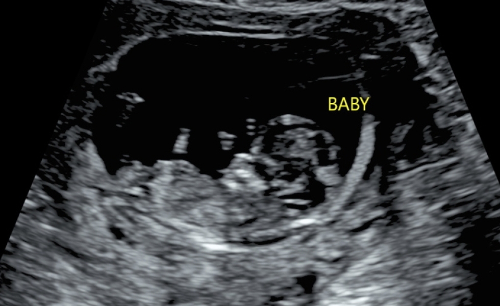 Gender guesses- nub theory