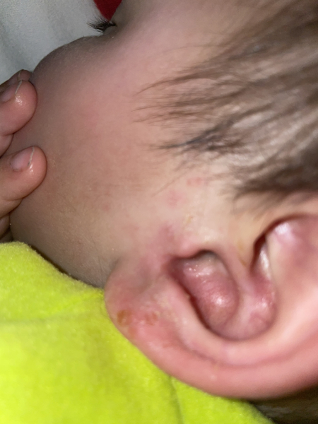 Leaking ear with visible pus.... it stinks bad
