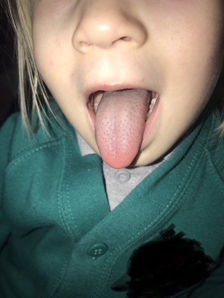 Strep A - please help (pic attached)