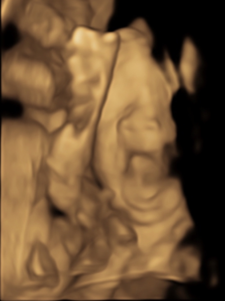 Due March 2023 - thread 5