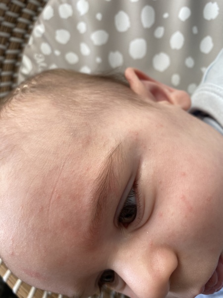 Spots!