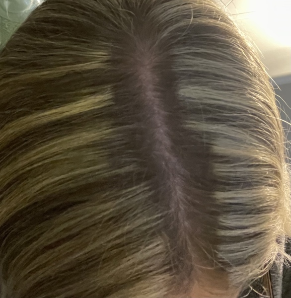 Is this normal for highlights?