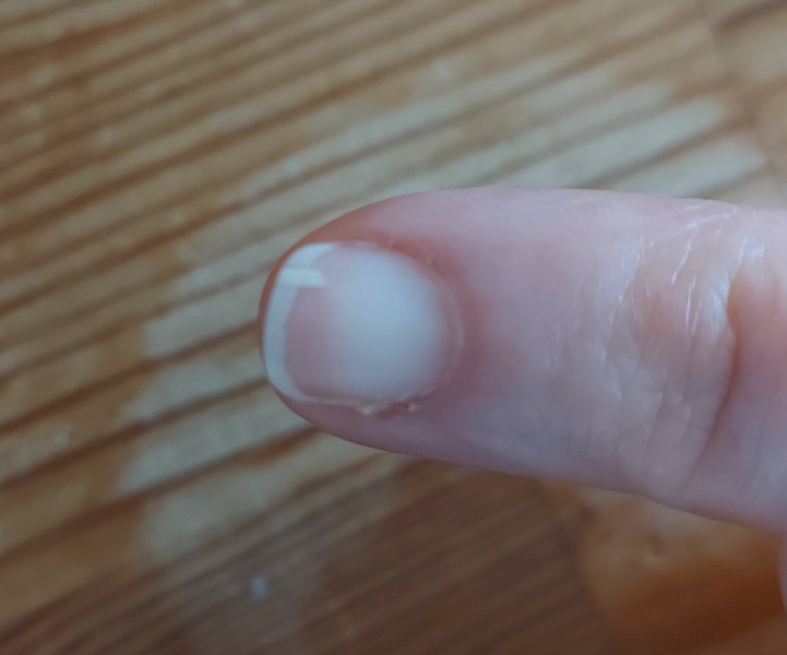 How do I fix this nail?
