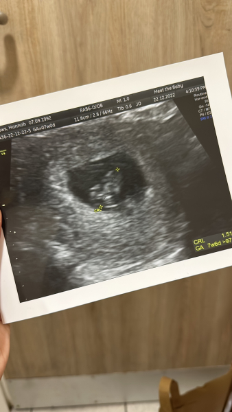 Due August 2023 (Thread 3)
