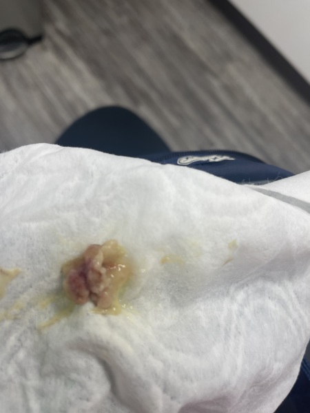 Any idea what this could be...GROSS PIC INCLUDED