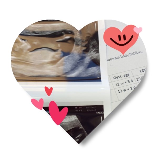 Trying to cope with late miscarriage at 18 weeks😪 