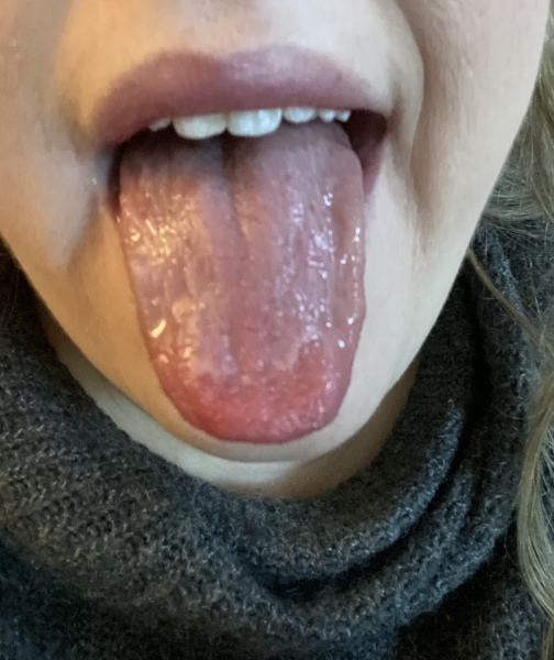 My tongue…pics included 