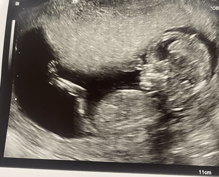 Gender guesses?? 
