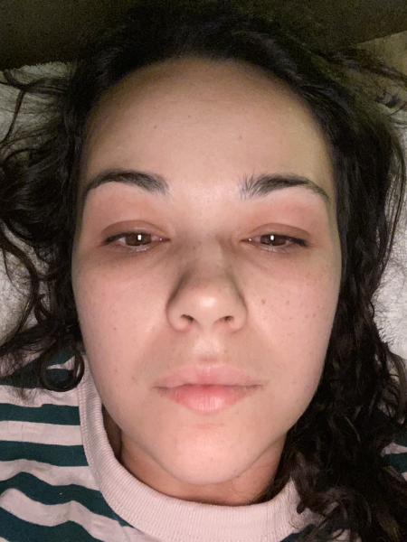 Just came over head to toe in a rash