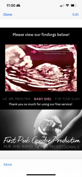 Baby 3D Scan … 