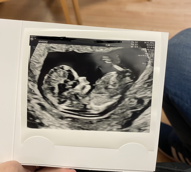 Just for fun but any boy/girl guesses!