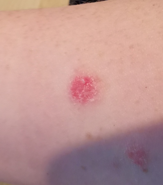What is this on my skin?! 