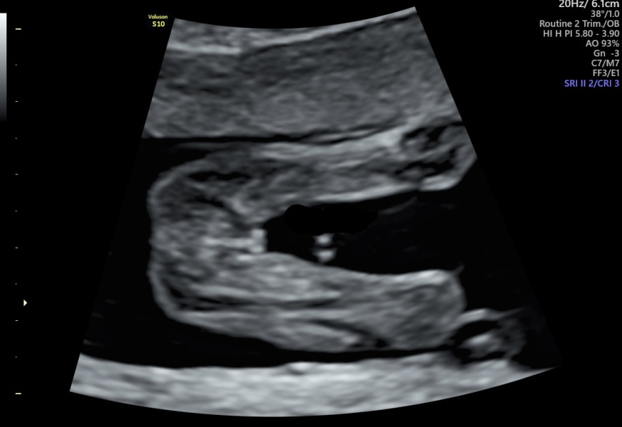 What do you think? Boy or girl?