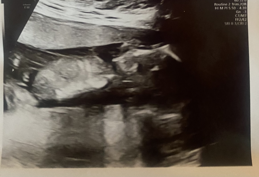 Trying to Conceive over 40 part 3