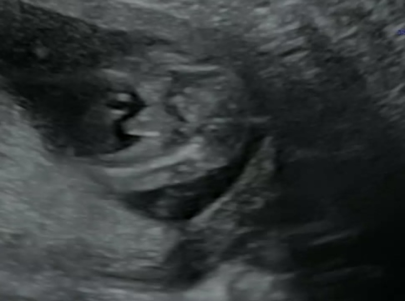 Potty shot - worried gender was wrong 