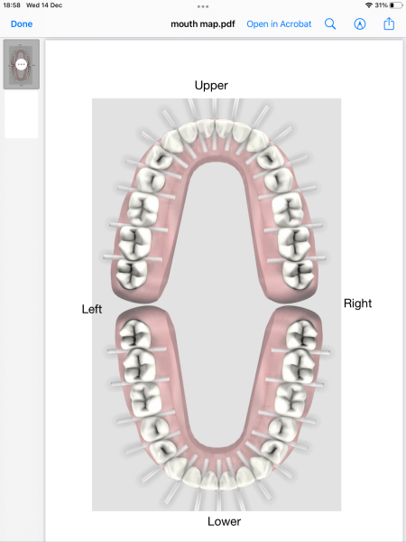 To be depressed by flossing
