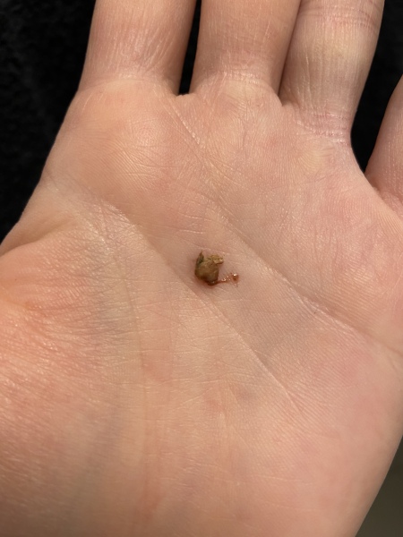 What just came out of me.. please help.. (warning, picture)