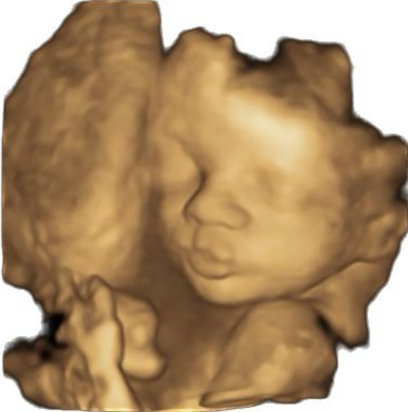 Due March 2023 - thread 5