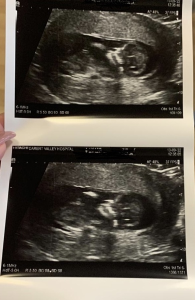 Due March 2023 - thread 5