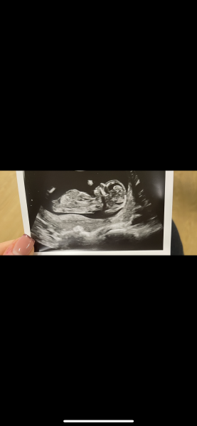 Anyone see a nub? 13 weeks