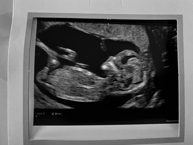 June 2023 Babies ☀️ (Thread 3) 