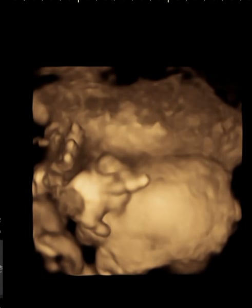 Due March 2023 - thread 5