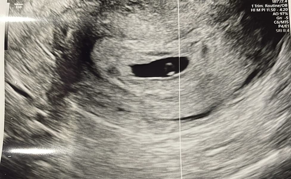 Due end of Aug/Sept babies 🤞🏻