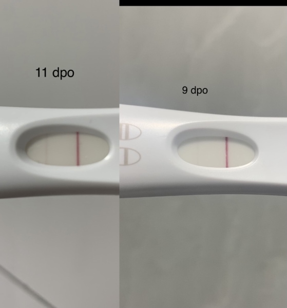 Short luteal phase?