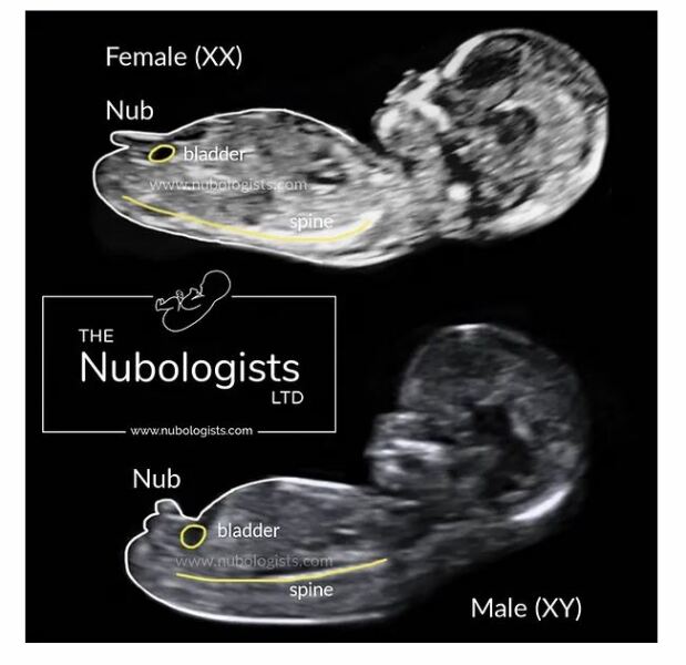 Boy or Girl?!