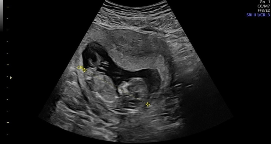 Boy or girl?