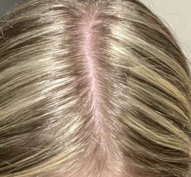 Is this normal for highlights?