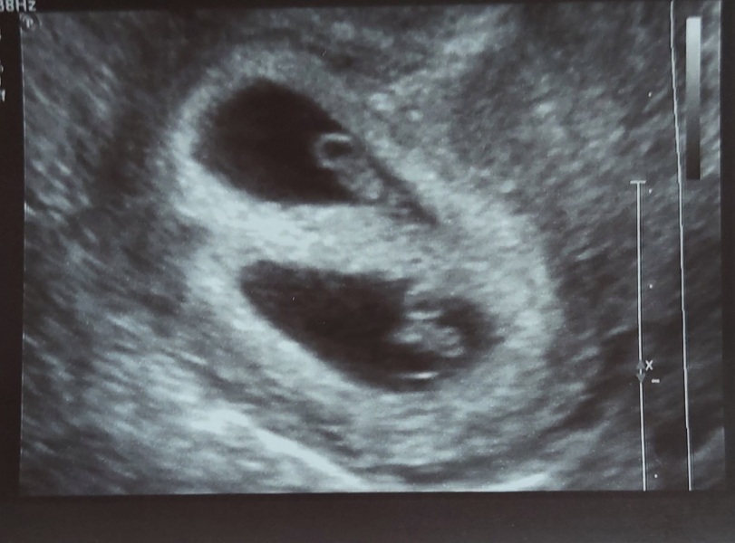 Due July 2023