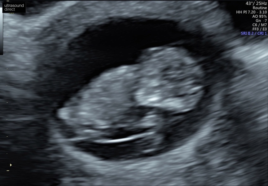 Boy or girl thoughts?