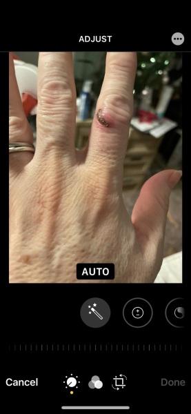 Is this finger infected? *pic*