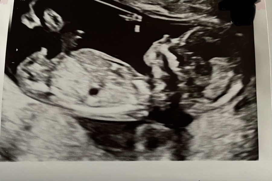 June 2023 Babies ☀️ (Thread 3) 