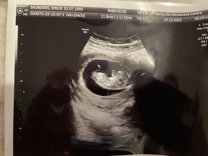 BOY OR GIRL?❤️💙