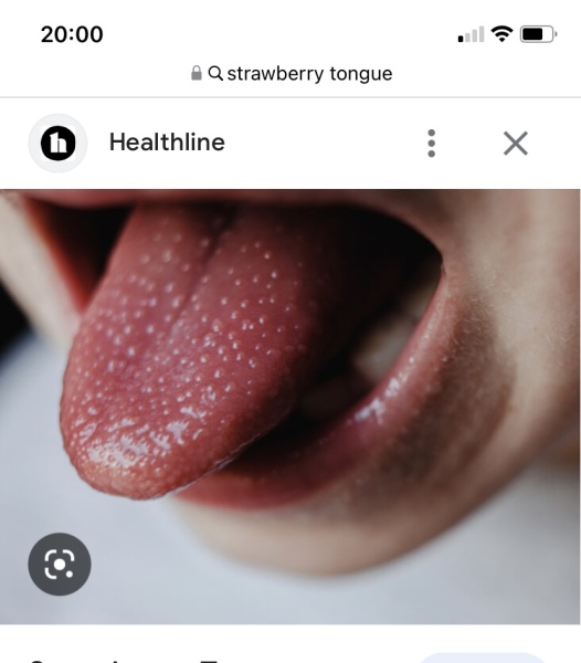 To be really annoyed with GP in light of strep A concerns? 
