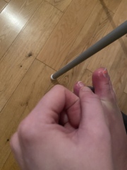 What is wrong with these swelled toes? 