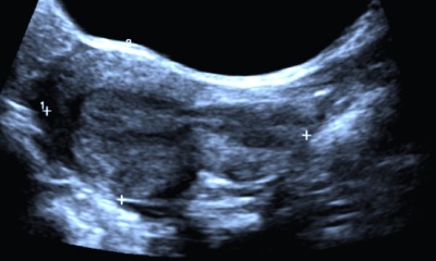 Due May 2023 - thread two