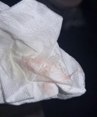 Am I having a miscarriage? (Images attached!)