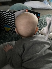 Suspected craniosynostosis