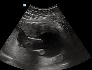 17 week scan boy or girl? 