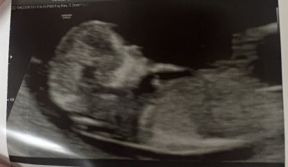 Fun boy or girl guesses?