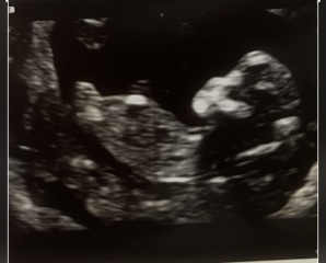 Gender guesses- nub theory