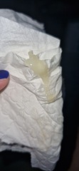 TMI - plug? (Pics)