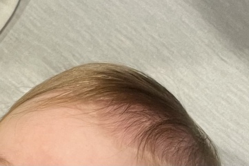 newborn hair turning orange?