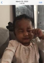 7 month old doing weird eye squeezing - really worried