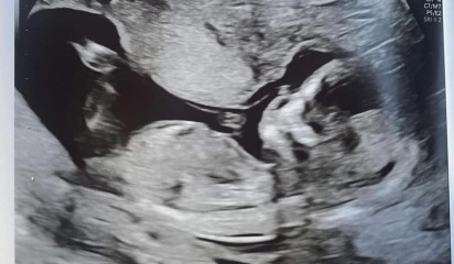 Boy or girl?