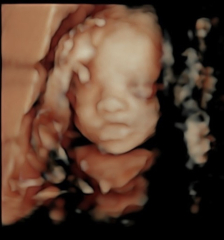 Due March 2023 - thread 5