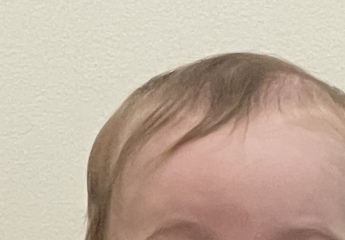 newborn hair turning orange?